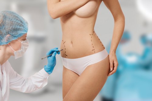 woman-marked-out-cosmetic-surgery.jpg